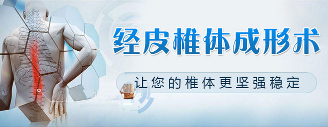 椎体强化术.jpg